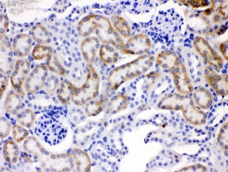 IHC testing of FFPE mouse kidney tissue with ACSL1 antibody at 1ug/ml. HIER: steam sections in pH6 citrate buffer for 20 min.