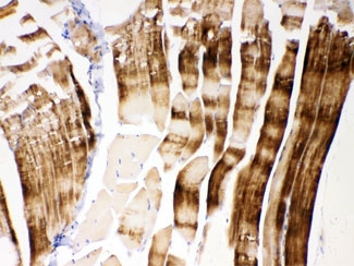 IHC testing of FFPE mouse skeletal muscle with ACTN3 antibody at 1ug/ml. HIER: steam sections in pH6 citrate buffer for 20 min.