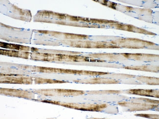 IHC testing of FFPE rat skeletal muscle with ACTN3 antibody at 1ug/ml. HIER: steam sections in pH6 citrate buffer for 20 min.