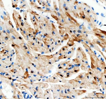 IHC staining of FFPE mouse heart tissue with AK1 antibody. HIER: boil tissue sections in pH8 EDTA for 20 min and allow to cool before testing.