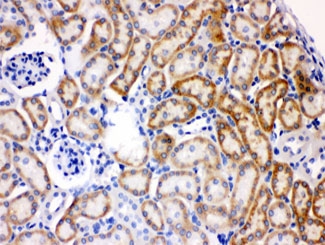 IHC testing of FFPE mouse kidney with AK2 antibody at 1ug/ml. HIER: steam sections in pH6 citrate buffer for 20 min.