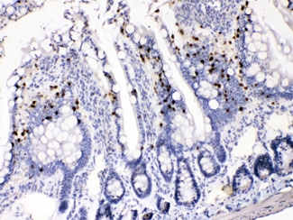 AKR1B1 Antibody Rat Intestine Gland IHC. Immunohistochemistry testing of FFPE rat intestine with AKR1B1 antibody at 1ug/ml. HIER: steam sections in pH6 citrate buffer for 20 min.