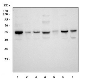 Western blot testing of human 1) HepG2, 2) K562, 3) A431, 4) A549, 5) U-2 OS, 6) HeLa and 7) monkey COS-7 cell lysate with ALDH1B1 antibody. Predicted molecular weight ~57 kDa.