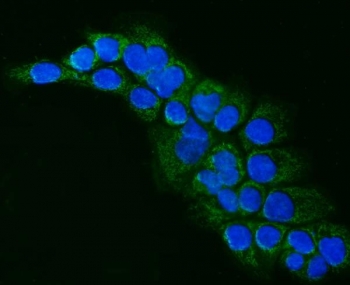 Immunofluorescent staining of FFPE human A431 cells with ALDH1B1 antibody (green) and DAPI nuclear stain (blue). HIER: steam section in pH6 citrate buffer for 20 min.