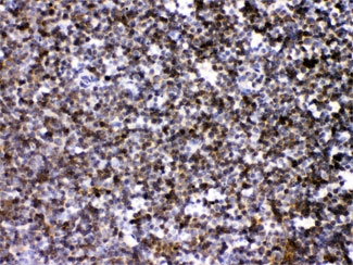 IHC testing of FFPE mouse lymph tissue with ARHGEF1 antibody at 1ug/ml. HIER: steam sections in pH6 citrate buffer for 20 min.