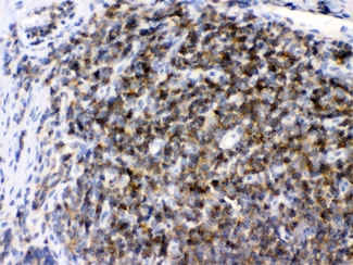 IHC testing of FFPE rat lymph tissue with ARHGEF1 antibody at 1ug/ml. HIER: steam sections in pH6 citrate buffer for 20 min.