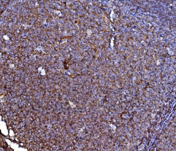 IHC staining of FFPE human tonsil tissue with CD40 antibody. HIER: boil tissue sections in pH8 EDTA for 20 min and allow to cool before testing.
