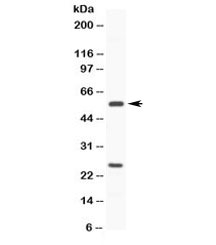 Western blot testing of human HeLa cell lysate with CYP3A4 antibody at 0.5ug/ml. Expected molecular weight: 50-57 kDa.