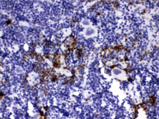 IHC staining of FFPE mouse spleen tissue with Neutrophil Elastase antibody, HRP-labeled secondary and DAB substrate. HIER: boil tissue sections in pH6 citrate buffer for 20 min and allow to cool before testing.