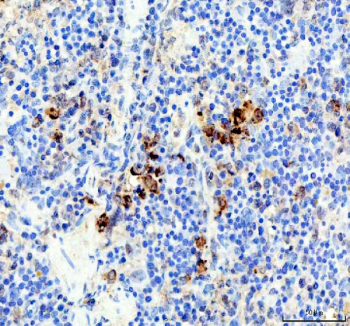 IHC staining of FFPE rat spleen tissue with Neutrophil Elastase antibody, HRP-labeled secondary and DAB substrate. HIER: boil tissue sections in pH8 EDTA buffer for 20 min and allow to cool before testing.