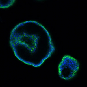 EpCAM Antibody Colon IF. Immunofluorescent staining of human colon tissue with EpCAM antibody (green) and DAPI (blue). HIER: steam sections in pH6 citrate buffer for 20 min.