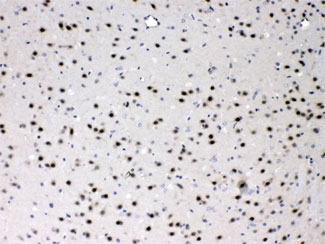 IHC testing of FFPE mouse brain with PSMA3 antibody at 1ug/ml. HIER: steam section in pH6 citrate buffer for 20 min.