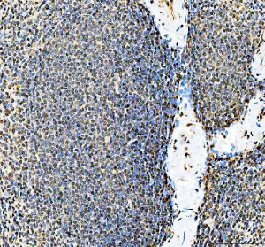 SAFB Antibody Human Tonsil IHC. Immunohistochemical staining of FFPE human tonsil demonstrated widespread SAFB expression with predominant nuclear staining throughout the lymphoid follicles and interfollicular regions. Heat-induced epitope retrieval was performed in pH8 EDTA buffer before staining with the primary antibody and HRP-DAB detection. The nuclear staining pattern is consistent with the role of Scaffold Attachment Factor in chromatin organization, transcriptional regulation and RNA processing within proliferating immune cells. This SAFB Antibody, a Scaffold Attachment Factor Antibody, is suitable for immunohistochemical studies of nuclear protein expression in lymphoid tissues and immune cell biology.