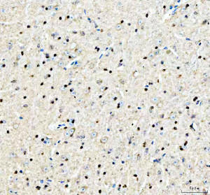SAFB Antibody Mouse Brain IHC. Immunohistochemical staining of FFPE mouse brain demonstrated widespread SAFB expression with prominent nuclear staining in neurons and other brain cells, accompanied by weaker diffuse cytoplasmic staining. Heat-induced epitope retrieval was performed in pH8 EDTA buffer before staining with the primary antibody and HRP-DAB detection. The predominantly nuclear localization is consistent with the role of Scaffold Attachment Factor in chromatin organization, transcriptional regulation and RNA processing within the central nervous system. This SAFB Antibody, a Scaffold Attachment Factor Antibody, is suitable for immunohistochemical studies of neuronal gene regulation and brain tissue biology.