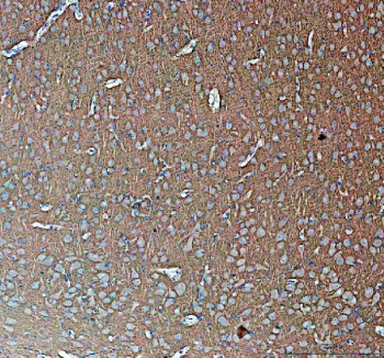 IHC staining of FFPE pig brain tissue with Synapsin II antibody, HRP-secondary and DAB substrate. HIER: boil tissue sections in pH8 EDTA for 20 min and allow to cool before testing.