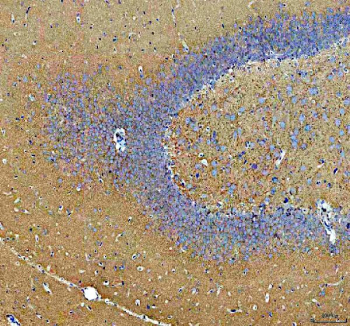 IHC staining of FFPE rat brain tissue with Synapsin II antibody, HRP-secondary and DAB substrate. HIER: boil tissue sections in pH8 EDTA for 20 min and allow to cool before testing.