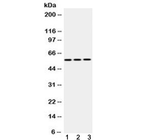 Western blot testing of 1) rat liver, 2) mouse liver and 3) human HepG2 lysate with CASP8 antibody at 0.5ug/ml. Predicted molecular weight: ~55 kDa (pro), ~40 kDa (large + small subunit), ~11 kDa (small subunit).