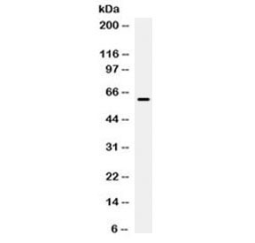 B7-H1 Antibody for WB. Western blot testing of human HeLa cell lysate with B7-H1 antibody at 0.5ug/ml. Expected molecular weight ~34/40-70 kDa (unmodified/glycosylated), observed here at ~62 kDa.