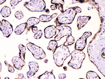 IHC testing of FFPE human placenta tissue with Calpastatin antibody at 1ug/ml. HIER: steam section in pH6 citrate buffer for 20 min.