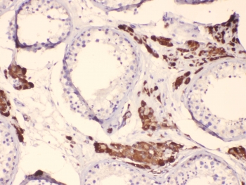 IHC testing of FFPE human testis tissue with CYP17A1 antibody. HIER: steam section in pH6 citrate buffer for 20 min.