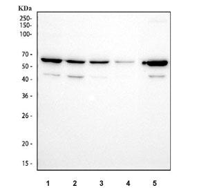 Western blot testing of 1) human SH-SY5Y, 2) human HepG2, 3) human HeLa, 4) human Jurkat and 5) rat testis tissue lysate with CYP17A1 antibody at 0.5ug/ml. Predicted molecular weight ~57 kDa.
