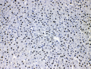 IHC testing of FFPE rat liver tissue with HDGF antibody at 1ug/ml. HIER: steam section in pH6 citrate buffer for 20 min.