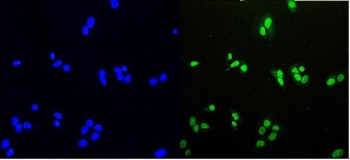 Immunofluorescent staining of FFPE human U-2 OS cells with HDGF antibody (green) and DAPI nuclear stain (blue). HIER: steam section in pH6 citrate buffer for 20 min.