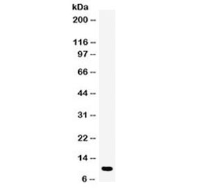 DBI Antibody Human Placenta WB. Western blot analysis of human placenta lysate using DBI antibody detects a prominent band at approximately 10 kDa, consistent with the predicted molecular weight of DBI / Diazepam binding inhibitor, a lipid-binding protein involved in acyl-CoA transport, neurosteroid regulation, and intracellular metabolic signaling.
