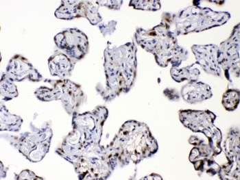 DBI Antibody Human Placenta IHC. Immunohistochemistry of FFPE human placenta tissue using DBI antibody demonstrates granular HRP-DAB brown cytoplasmic staining in placental trophoblast-associated cells, consistent with DBI / Diazepam binding inhibitor expression linked to intracellular lipid metabolism, steroid-associated signaling, and acyl-CoA-binding activity. HIER: steam sections in pH6 citrate buffer for 20 min.