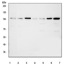 Western blot testing of 1) human HeLa, 2) human MCF7, 3) human HepG2, 4) rat skeletal muscle, 5) rat heart, 6) mouse skeletal muscle and 7) mouse heart tissue lysate with Hexokinase II antibody at 0.5ug/ml.  Predicted molecular weight ~102 kDa.
