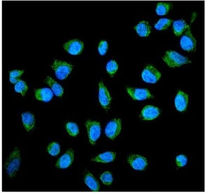 PLAP Antibody HeLa IF. Immunofluorescence analysis of formalin-fixed, paraffin-embedded human HeLa cells stained with PLAP Antibody demonstrates cytoplasmic and membranous fluorescence signal (green) consistent with expression of placental alkaline phosphatase / ALPP in epithelial-derived tumor cells. This germ cell tumor marker antibody highlights peripheral membranous and cytoplasmic localization patterns associated with placental alkaline phosphatase expression in transformed epithelial cell populations. Nuclei are counterstained with DAPI (blue). Heat-induced epitope retrieval was performed by steaming sections in pH 6 citrate buffer for 20 min prior to antibody incubation.