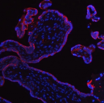 PLAP Antibody Placenta IF. Immunofluorescence analysis of formalin-fixed, paraffin-embedded human placenta tissue stained with PLAP Antibody demonstrates strong membranous fluorescence signal outlining chorionic villi and syncytiotrophoblast-associated epithelial surfaces (red), consistent with expression and surface localization of placental alkaline phosphatase / ALPP in trophoblastic cellular compartments. This germ cell tumor marker antibody highlights the characteristic membrane distribution of PLAP within placental tissue. Nuclei are counterstained with DAPI (blue). Heat-induced epitope retrieval was performed by steaming sections in pH 8 EDTA buffer for 20 min prior to antibody incubation.