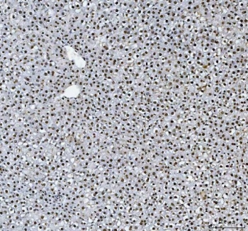 IHC staining of FFPE rat liver tissue with hnRNP L antibody. HIER: boil tissue sections in pH8 EDTA for 20 min and allow to cool before testing.