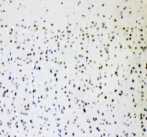 AFF4 Antibody Rat Brain IHC. Immunohistochemical staining of FFPE rat brain tissue using AFF4 Antibody / AF4/FMR2 Family Member 4 Antibody at 2 ug/ml. Heat-induced epitope retrieval was performed using pH8 EDTA buffer, followed by HRP-conjugated secondary antibody detection and DAB chromogen. Predominantly nuclear staining is observed throughout the brain parenchyma, consistent with the expected localization of the transcriptional regulator AFF4. This AFF4 Antibody, also called AF4/FMR2 Family Member 4 Antibody, is suitable for studies of transcription elongation, nuclear protein expression, Super Elongation Complex biology, and gene regulation.