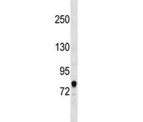 Western blot testing of human HepG2 cell lysate with ACSL3 antibody at 0.5ug/ml. Predicted molecular weight ~80 kDa.