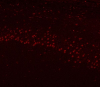 Immunofluorescent staining of FFPE rat brain tissue with hnRNP H antibody (red). HIER: steam section in pH8 EDTA buffer for 20 min.