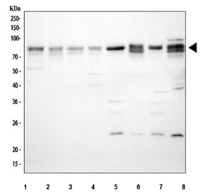 ARNTL Antibody Human, Rat and Mouse WB. Western blot analysis of ARNTL Antibody / Aryl Hydrocarbon Receptor Nuclear Translocator Like Antibody detected a major band at approximately 69 kDa, consistent with the predicted molecular weight of ARNTL. Lane 1: human HeLa; Lane 2: human HT-1080; Lane 3: human MCF7; Lane 4: human SH-SY5Y; Lane 5: rat brain; Lane 6: rat liver; Lane 7: mouse brain; Lane 8: mouse liver lysate. The membrane was incubated with ARNTL antibody followed by an HRP-conjugated secondary antibody. This ARNTL Antibody, an Aryl Hydrocarbon Receptor Nuclear Translocator Like antibody, detects endogenous ARNTL across human, rat and mouse samples for studies of circadian rhythm regulation and transcriptional control.