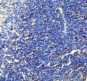 IHC staining of FFPE mouse thymus tissue with Survivin antibody. HIER: boil tissue sections in pH8 EDTA for 20 min and allow to cool before testing.