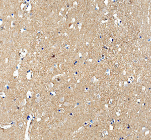 HRAS Antibody in Human Cerebral Cortex IHC. Immunohistochemistry staining of FFPE human cerebral cortex tissue with HRAS Antibody / HRas Proto-Oncogene GTPase Antibody at 2 ug/ml. Heat-induced epitope retrieval (HIER) was performed in EDTA buffer, pH 8.0, followed by blocking with 10% goat serum. The tissue was incubated with the primary antibody overnight at 4oC, followed by a peroxidase-conjugated goat anti-rabbit IgG secondary antibody for 30 min at 37oC and DAB detection. HRAS staining is observed throughout the cerebral cortex. This HRAS Antibody demonstrates detection of HRas proto-oncogene GTPase in human brain tissue.