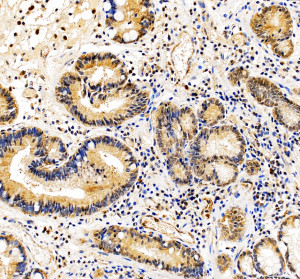HRAS Antibody in Human Stomach IHC. Immunohistochemistry staining of FFPE human stomach tissue with HRAS Antibody / HRas Proto-Oncogene GTPase Antibody at 2 ug/ml. Heat-induced epitope retrieval (HIER) was performed in EDTA buffer, pH 8.0, followed by blocking with 10% goat serum. The tissue was incubated with the primary antibody overnight at 4oC, followed by a peroxidase-conjugated goat anti-rabbit IgG secondary antibody for 30 min at 37oC and DAB detection. HRAS staining is observed in the gastric glandular epithelium. This HRAS Antibody demonstrates detection of HRas proto-oncogene GTPase in human stomach tissue.