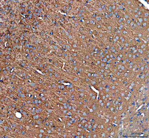 HRAS Antibody in Mouse Brain IHC. Immunohistochemistry staining of FFPE mouse brain tissue with HRAS Antibody / HRas Proto-Oncogene GTPase Antibody at 2 ug/ml. Heat-induced epitope retrieval (HIER) was performed in EDTA buffer, pH 8.0, followed by blocking with 10% goat serum. The tissue was incubated with the primary antibody overnight at 4oC, followed by a peroxidase-conjugated goat anti-rabbit IgG secondary antibody for 30 min at 37oC and DAB detection. HRAS staining is observed throughout the brain tissue, including neuronal populations. This HRAS Antibody demonstrates detection of HRas proto-oncogene GTPase in mouse brain tissue.