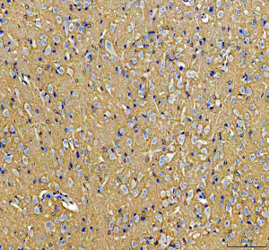HRAS Antibody in Rat Brain IHC. Immunohistochemistry staining of FFPE rat brain tissue with HRAS Antibody / HRas Proto-Oncogene GTPase Antibody at 2 ug/ml. Heat-induced epitope retrieval (HIER) was performed in EDTA buffer, pH 8.0, followed by blocking with 10% goat serum. The tissue was incubated with the primary antibody overnight at 4oC, followed by a peroxidase-conjugated goat anti-rabbit IgG secondary antibody for 30 min at 37oC and DAB detection. HRAS staining is observed throughout the brain tissue, including neuronal populations. This HRAS Antibody demonstrates detection of HRas proto-oncogene GTPase in rat brain tissue.