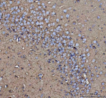 IHC testing of FFPE mouse brain tissue with CD90 antibody. Required HIER: steam section in pH8 EDTA for 20 min and allow to cool prior to testing.