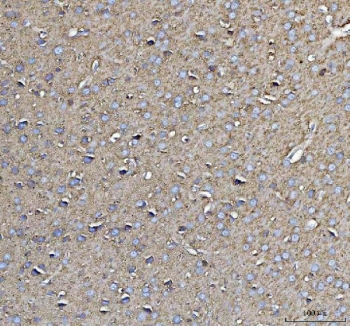 IHC testing of FFPE rat brain tissue with CD90 antibody. Required HIER: steam section in pH8 EDTA for 20 min and allow to cool prior to testing.