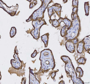 Cytokeratin 8 Antibody Human Placenta IHC. Immunohistochemical staining of FFPE human placenta tissue using Cytokeratin 8 Antibody / KRT8 Antibody at 2 ug/ml. Heat-induced epitope retrieval was performed using pH8 EDTA buffer, followed by HRP-conjugated secondary antibody detection and DAB chromogen. Strong membranous and cytoplasmic staining is observed in placental trophoblasts, consistent with the expected localization of Cytokeratin 8 in epithelial-derived cells. This Cytokeratin 8 Antibody, also called KRT8 Antibody, is suitable for studies of epithelial differentiation, intermediate filament organization, placental biology, and Cytokeratin 8 protein localization.