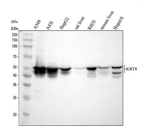 Cytokeratin 8 Antibody Human, Rat and Mouse WB. Western blot analysis of lane 1: human A549, lane 2: human A431, lane 3: human HepG2, lane 4: rat liver, lane 5: rat RH35, lane 6: mouse liver, and lane 7: mouse Hepa1-6 lysates using Cytokeratin 8 Antibody / KRT8 Antibody at 0.5 ug/ml. A specific band was detected at approximately 54 kDa, consistent with the expected molecular weight of Cytokeratin 8, with additional lower molecular weight bands observed in selected samples that may represent processed or tissue-specific forms. This Cytokeratin 8 Antibody, also called KRT8 Antibody, is suitable for studies of epithelial differentiation, intermediate filament organization, epithelial biology, and Cytokeratin 8 protein expression across multiple species.