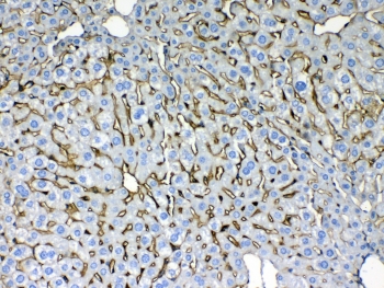 Cytokeratin 8 Antibody Mouse Liver IHC. Immunohistochemical staining of FFPE mouse liver tissue using Cytokeratin 8 Antibody at 1 Âµg/ml demonstrates distinct membranous and cytoplasmic HRP-DAB brown staining within hepatocytes throughout the hepatic parenchyma. The staining pattern is consistent with expression of Cytokeratin 8 (CK8/KRT8), a type II intermediate filament protein that contributes to epithelial cytoskeletal organization and structural integrity. Cytokeratin 8 immunoreactivity highlights hepatocellular morphology and cell boundaries, supporting its utility as a marker of epithelial lineage and hepatic tissue architecture. Required HIER: steam tissue sections in pH 6 citrate buffer for 20 minutes and allow to cool prior to testing.