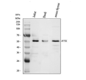 ETS1 Antibody Human and Mouse WB. Western blot analysis of human Jurkat (lane 1) and Daudi (lane 2) whole cell lysates, and mouse thymus tissue (lane 3) using ETS1 Antibody at 0.5 ug/ml. A specific band is detected at approximately 50 kDa in all samples, consistent with the predicted molecular weight of ETS1. This ETS1 Antibody is suitable for studies of ETS family transcription factors, lymphocyte development, immune cell signaling, and transcriptional regulation.
