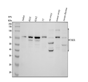 Western blot analysis of TSH Receptor Antibody / TSHR. Proteins were separated by 10% SDS-PAGE and transferred to a nitrocellulose membrane for immunodetection. Lane 1: human Jurkat whole cell lysates; Lane 2: human REH whole cell lysates; Lane 3: human K562 whole cell lysates; Lane 4: human TT whole cell lysates; Lane 5: rat ovary tissue lysates; Lane 6: mouse ovary tissue lysates; Lane 7: mouse thymus tissue lysates. Multiple immunoreactive bands corresponding to TSHR are observed, including species migrating at approximately 40 kDa, 70-80 kDa, and 110 kDa. The predicted molecular weight of full-length TSHR is approximately 87 kDa based on amino acid sequence. The higher molecular weight band is consistent with glycosylated full-length receptor, while lower molecular weight bands likely represent proteolytic cleavage products and partially processed receptor forms. Such banding heterogeneity is well documented for TSHR due to extensive N-linked glycosylation, extracellular domain cleavage, and variable post-translational processing across tissues and cell types.