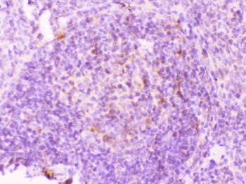 IHC testing of FFPE rat spleen tissue with MMP11 antibody at 1ug/ml. Required HIER: steam section in pH6 citrate buffer for 20 min and allow to cool prior to testing.